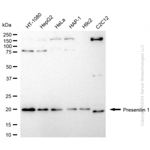 KD-Validated PSEN1 Rabbit mAb (20 μl)