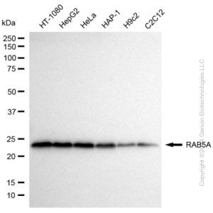 KD-Validated RAB5A Rabbit mAb (20 μl)