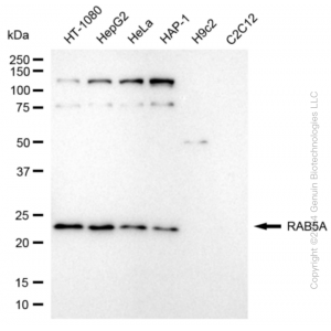 KD-Validated RAB5A Rabbit mAb (20 μl)