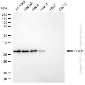 KD-Validated BCL10 Rabbit mAb (20 μl)