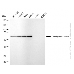 KD-Validated CHEK2 Rabbit mAb (20 μl)