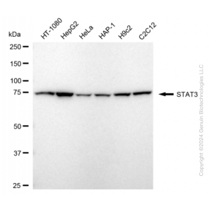 KD-Validated STAT3 Rabbit mAb (20 μl)