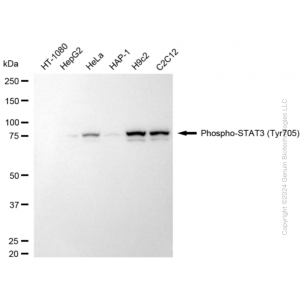 KD-Validated Phospho-STAT3 (Tyr705) Rabbit mAb (20 μl)