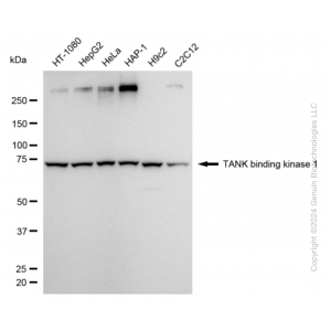 KD-Validated TBK1 Rabbit mAb (20 μl)