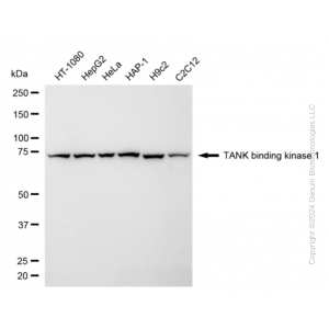 KD-Validated TBK1 Rabbit mAb (20 μl)