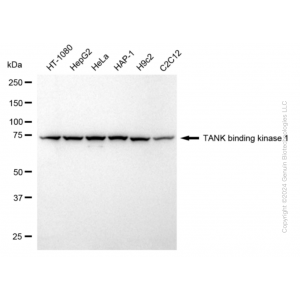 KD-Validated TBK1 Rabbit mAb (20 μl)