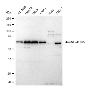KD-Validated NF-kB p65 Rabbit mAb (20 μl)