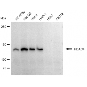 KD-Validated HDAC4 Rabbit mAb (20 μl)