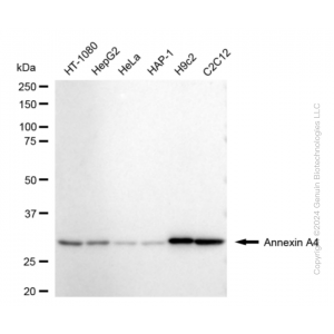 KD-Validated ANXA4 Rabbit mAb (20 μl)