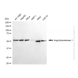 KD-Validated ATE1 Rabbit mAb (20 μl)