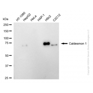 KD-Validated CALD1 Rabbit mAb (20 μl)