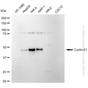 KD-Validated CCNE1 Rabbit mAb (20 μl)