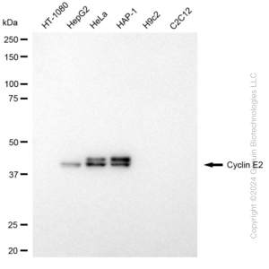 KD-Validated CCNE2 Rabbit mAb (20 μl)