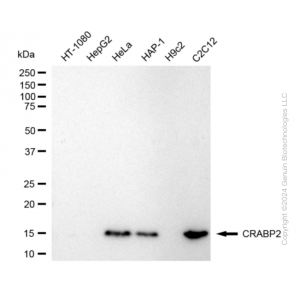 KD-Validated CRABP2 Rabbit mAb (20 μl)