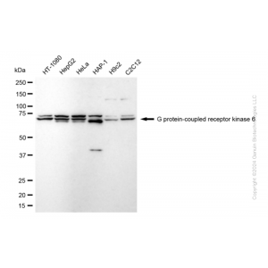 KD-Validated GRK6 Rabbit mAb (20 μl)