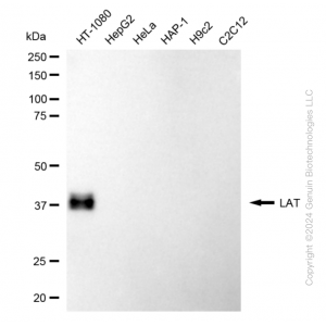 KD-Validated LAT Rabbit mAb (20 μl)