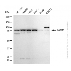 KD-Validated MCM5 Rabbit mAb (20 μl)