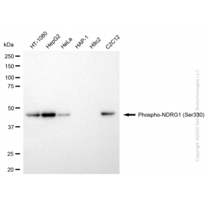 KD-Validated Phospho-NDRG1 (Ser330) Rabbit mAb (20 μl)