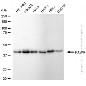 KD-Validated PAWR Rabbit mAb (20 μl)