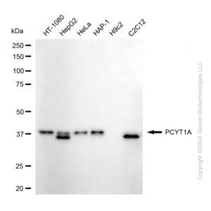 KD-Validated PCYT1A Rabbit mAb (20 μl)