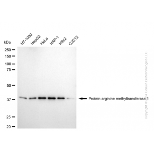 KD-Validated PRMT1 Rabbit mAb (20 μl)