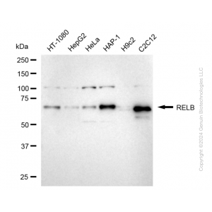 KD-Validated RELB Rabbit mAb (20 μl)