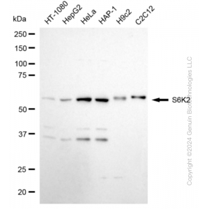 KD-Validated RPS6KB2 Rabbit mAb (20 μl)
