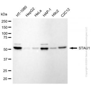 KD-Validated STAU1 Rabbit mAb (20 μl)