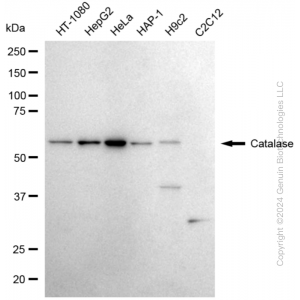 KD-Validated CAT Rabbit mAb (20 μl)