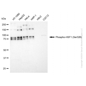 KD-Validated Phospho-HSF1 (Ser326) Rabbit mAb (20 μl)