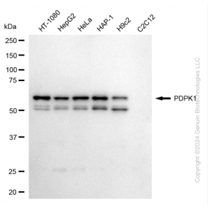 KD-Validated PDPK1 Rabbit mAb (20 μl)