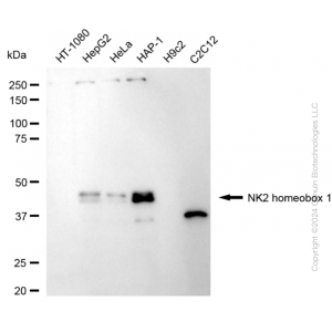 KD-Validated NKX2-1 Rabbit mAb (20 μl)