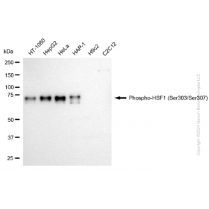 KD-Validated Phospho-HSF1 (Ser303/Ser307) Rabbit mAb (20 μl)