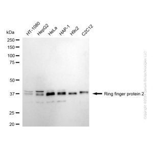 KD-Validated RNF2 Rabbit mAb (20 μl)