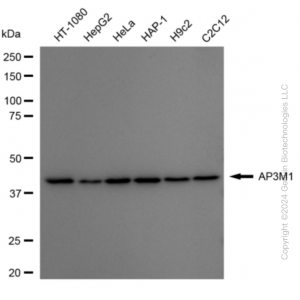 KD-Validated AP3M1 Rabbit mAb (20 μl)