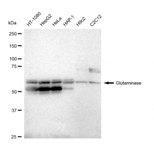 KD-Validated GLS Rabbit mAb (20 μl)