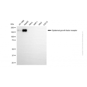 KD-Validated EGFR Mouse mAb (20 μl)