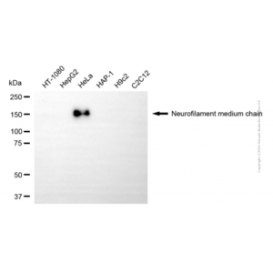 KD-Validated NEFM Mouse mAb (20 μl)