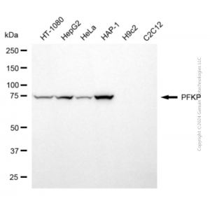 KD-Validated PFKP Mouse mAb (20 μl)