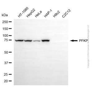 KD-Validated PFKP Mouse mAb (20 μl)