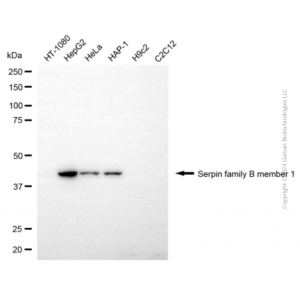 KD-Validated SERPINB1 Mouse mAb (20 μl)