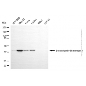 KD-Validated SERPINB1 Mouse mAb (20 μl)