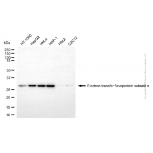 KD-Validated ETFA Mouse mAb (20 μl)