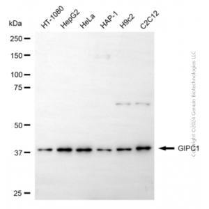 KD-Validated GIPC1 Mouse mAb (20 μl)