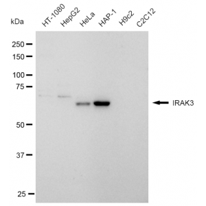 KD-Validated IRAK3 Rabbit mAb (20 μl)