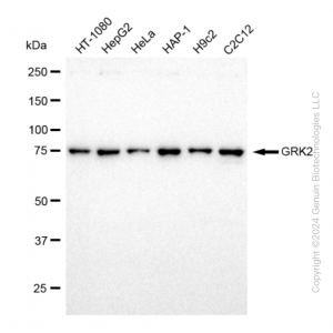 KD-Validated GRK2 Rabbit mAb (20 μl)