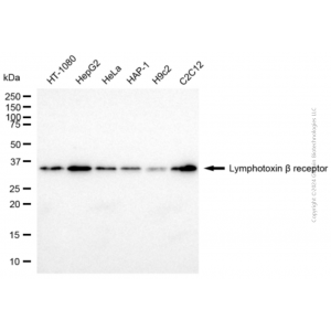 KD-Validated LTBR Mouse mAb (20 μl)