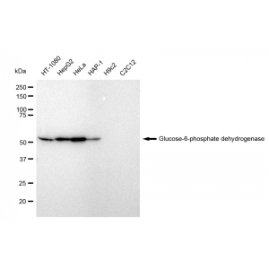 KD-Validated G6PD Rabbit mAb (20 μl)