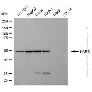 KD-Validated HARS1 Mouse mAb (20 μl)