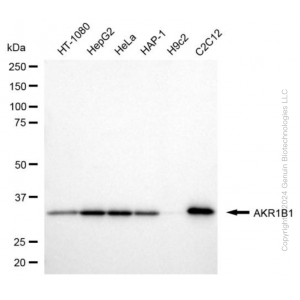 KD-Validated AKR1B1 Mouse mAb (20 μl)